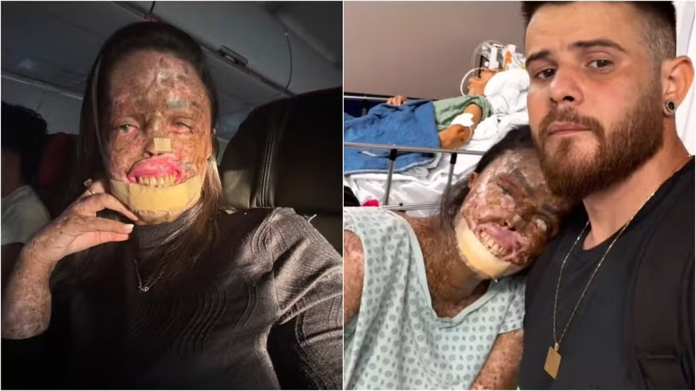 Ela passou a vida fugindo do sol, mas iluminou milhares de pessoas: quem era Káh Felipe